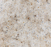 IHC staining of FFPE human brain tissue with GFAP antibody. HIER: boil tissue sections in pH8 EDTA for 20 min and allow to cool before testing.