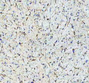 IHC staining of FFPE mouse brain tissue with GFAP antibody. HIER: boil tissue sections in pH8 EDTA for 20 min and allow to cool before testing.