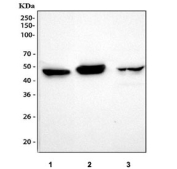 Western blot testing of 1) human U-251, 2) rat brain and 3) mouse brain tissue lysate with GFAP antibody. Predicted molecular weight ~50 kDa.