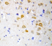 IHC-P: 5HT2A Receptor antibody testing of rat brain tissue