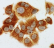 ICC testing of MCF-7 cells with MEK1 antibody.