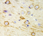 IHC-P: GAD65 antibody testing of rat brain tissue. Required HIER: steam section in pH6 citrate buffer for 20 min.
