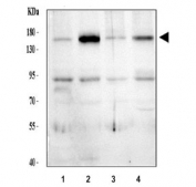 Western blot testing of human 1) HeLa, 2) MCF7, 3) U-87 MG and 4) U-251 cell lysate with Thrombospondin 2 antibody. Expected molecular weight: 130-170 kDa depending on glycosylation level.