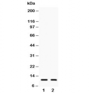 Western blot testing of human 1) COLO320 and 2) A549 lysate with Eotaxin antibody  Predicted molecular weight ~11 kDa.