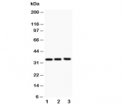 Western blot testing of GM-CSF antibody and Lane 1:  Jurkat;  2: HeLa;  3: HT1080;  The protein is visualized between 14~35KD depending on glycosylation.