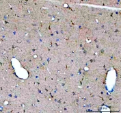 IHC staining of FFPE rat brain tissue with GDNF antibody. HIER: boil tissue sections in pH8 EDTA for 20 min and allow to cool before testing.