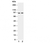 Western blot testing of ADAMTS4 antibody and Lane 1:  rat brain;  2: mouse brain tissue lysate
