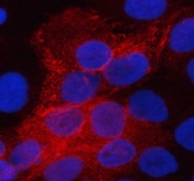 Immunofluorescent staining of FFPE human A431 cells with AQP3 antibody (red) and DAPI nuclear stain (blue). HIER: steam section in pH6 citrate buffer for 20 min.