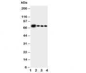 Western blot testing of GCLC antibody and Lane 1:  rat brain;  2: rat kidney;  3: rat heart;  4: rat lung tissue lysate