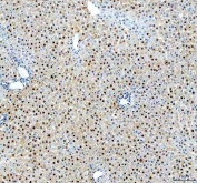 IHC staining of FFPE rat liver tissue with APEX1 antibody. HIER: boil tissue sections in pH8 EDTA for 20 min and allow to cool before testing.