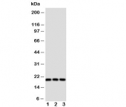 Western blot testing of Thy1 antibody and Lane 1:  rat brain;  2: rat liver;  3: rat thymus tissue lysate. Predicted molecular weight 18~35kDa depending on glycosylation level.