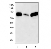 Western blot testing of 1) rat spleen, 2) mouse spleen and 3) mouse RAW264.7 cell lysate with Cd68 antibody.  This protein can be highly glycosylated and is routinely visualized from 37~110 kDa.