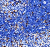 IHC staining of FFPE rat spleen tissue with Cd68 antibody. HIER: boil tissue sections in pH8 EDTA for 20 min and allow to cool before testing.
