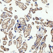 IHC testing of FFPE human placental tissue with Canstatin / Collagen IV antibody at 1ug/ml. Required HIER: steam section in pH8 EDTA buffer for 20 min and allow to cool prior to staining.