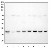 Western blot testing of human 1) Jurkat, 2) HepG2, 3) U-2 OS, 4) K562, 5) T-47D, 6) Caco-2, 7) 293T and 8) PC-3 cell lysate with Cdk2 antibody. Predicted molecular weight ~33 kDa.