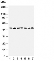Western blot testing of CTBP1 antibody and Lane 1:  rat brain;  2: rat testis;  3: rat ovary;  4: U87;  5: SW620;  6: HT1080;  7: COLO320 cell lysate. Predicted/observed molecular weight: ~47kDa.