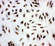 ICC staining of human A549 cells.