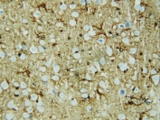 IHC testing of FFPE rat brain tissue with HSF2 antibody at 1ug/ml. Required HIER: steam section in pH6 citrate buffer for 20 min and allow to cool prior to testing.