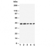 Western blot testing of IL-2 Receptor antibody and Lane 1:  PANC;  2: HeLa;  3: Jurkat;  4: Raji;  5: CEM cell lysate.  Expected size: 42KD