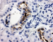 IHC-P: Kallikrein-1 antibody testing of rat kidney tissue