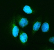 Immunofluorescent staining of FFPE human U-2 OS cells with p65 antibody (green) and DAPI nuclear stain (blue). HIER: steam section in pH6 citrate buffer for 20 min.