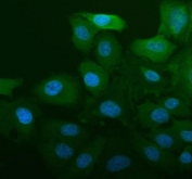 Immunofluorescent staining of FFPE human A549 cells with ALDH1A1 antibody (blue) and DAPI nuclear stain (blue). HIER: steam section in pH6 citrate buffer for 20 min.