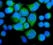 Immunofluorescent staining of FFPE human SiHa cells with Myosin Phosphatase antibody (green) and DAPI nuclear stain (blue). HIER: steam section in pH6 citrate buffer for 20 min.