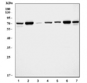 Western blot testing of 1) rat brain, 2) rat kidney, 3) rat spleen, 4) rat liver, 5) mouse brain, 6) mouse kidney and 7) mouse liver tissue lysate with SDHA antibody.  Predicted molecular weight: 57-73 kDa (multiple isoforms).
