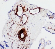 IHC-P: SERCA1 ATPase antibody testing of human placenta tissue