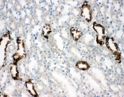 IHC-F testing of AQP2 antibody and rat kidney tissue