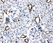 IHC-P: AQP2 antibody testing of rat kidney tissue