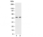 Western blot testing of CD2 antibody and Lane 1:  rat spleen;  2: mouse NIH3T3 cell lysate