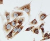 ICC testing of rat PC3 cells with Kallikrein 6 antibody