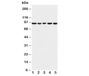 Western blot testing of MCM6 antibody and Lane 1:  U87;  2: COLO320;  3: HeLa;  4: MCF-7;  5: Jurkat cell lysate. Expected molecular weight: 92-105 kDa.