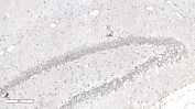 IHC staining of FFPE rat brain tissue with Aryl hydrocarbon Receptor antibody. HIER: boil tissue sections in pH8 EDTA for 20 min and allow to cool before testing.