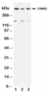 Western blot testing of ATM antibody and Lane 1:  rat testis;  2: U87;  3: MCF-7