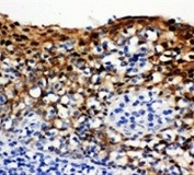 IHC-P: 14-3-3 sigma antibody testing of human tonsil tissue. HIER: boil tissue sections in pH6, 10mM citrate buffer, for 20 min and allow to cool before testing.