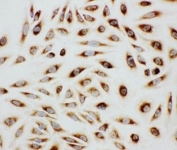 ICC testing of Paxillin antibody and HeLa cells.