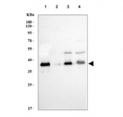 Western blot testing of human 1) 293T, 2) PC-3, 3) K562 and 4) HepG2 cell lysate with Arg2 antibody.  Expected molecular weight ~38 kDa.