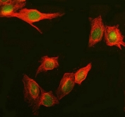 Immunofluorescent staining of FFPE human U-2 OS cells with Daxx antibody (green) and Beta Tubulin mAb (red). HIER: steam section in pH6 citrate buffer for 20 min.