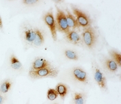 ICC testing of HSP70 antibody and human A549 cells.