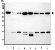 Western blot testing of 1) rat liver, 2) rat kidney, 3) rat brain, 4) rat RH35, 5) mouse liver, 6) mouse kidney, 7) mouse brain and 8) mouse NIH 3T3 cell lysate with HSP70 antibody. Expected molecular weight ~70 kDa.
