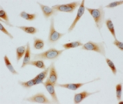 ICC testing of BiP antibody and HeLa cells