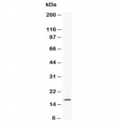 Western blot testing of Myoglobin antibody and human placenta tissue lysate. Predicted molecular weight ~17 kDa.