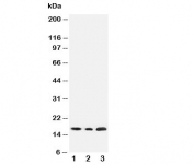 Western blot testing of SDHC antibody and Lane 1:  rat liver;  2: HeLa;  3: Jurkat cell lysate