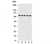 Western blot testing of ABCG5 antibody and human lysate samples 1:  MCF-7;  2: A549;  3: HT1080;  4: U-87 MG;  5: SKOV.  Predicted molecular weight ~73 kDa.