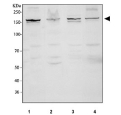 Western blot testing of 1) huma A549, 2) human SH-SY5Y, 3) rat PC-12 and 4) mouse NIH 3T3 cell lysate with MAP3K1 antibody.  Predicted molecular weight ~162 kDa.