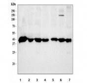 Western blot testing of 1) human HeLa, 2) human Jurkat, 3) human MCF7, 4) monkey COS-7, 5) human SK-OV-3, 6) human A549 and 7) human 22RV1 cell lysate with Nucleophosmin antibody. Expected molecular weight: ~38 kDa.