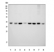 Western blot testing of 1) rat C6, 2) rat NRK, 3) rat PC-12, 4) rat RH35, 5) mouse ANA-1, 6) mouse RAW264.7, 7) mouse Neuro-2a and 8) mouse HEPA1-6 cell lysate with Nucleophosmin antibody. Expected molecular weight: ~38 kDa.