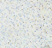 IHC staining of FFPE rat brain tissue with Aquaporin 4 antibody. HIER: boil tissue sections in pH8 EDTA for 20 min and allow to cool before testing.